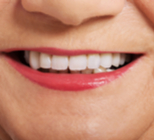 טיפולי שיניים מסובסדים לפנסיונרים וניצולי שואה-תמונה